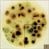 霉菌酵母菌测试片