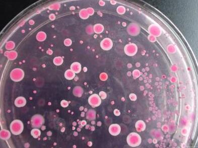 霉菌和酵母菌及其检验