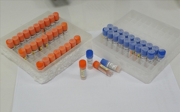 生物指示剂有哪些分类？它的应用情况是这样的！