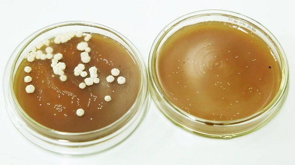 常见微生物菌种的种类有哪些？它应该这样去进行保存！