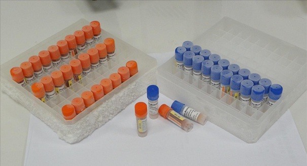 生物指示剂的参数要怎么测定？它的应用详情也一起告诉你！