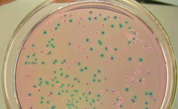 微生物菌种有哪些相关概念？检验时要注意这些事情！