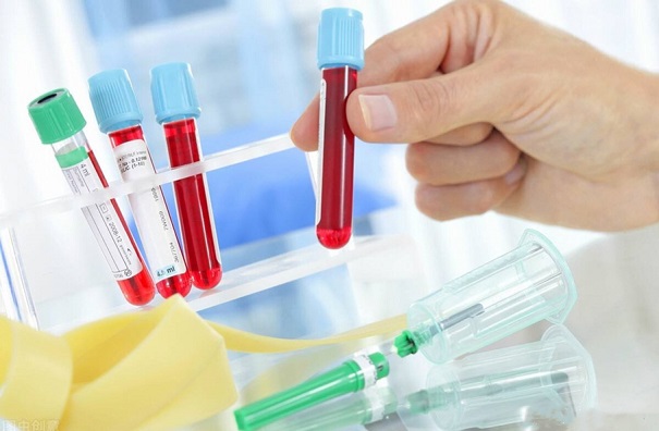 生物指示剂要怎么正常使用？要做好这些安全保护措施！
