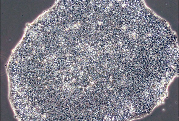 液体微生物培养基有什么好处？它的种类总共有这些！