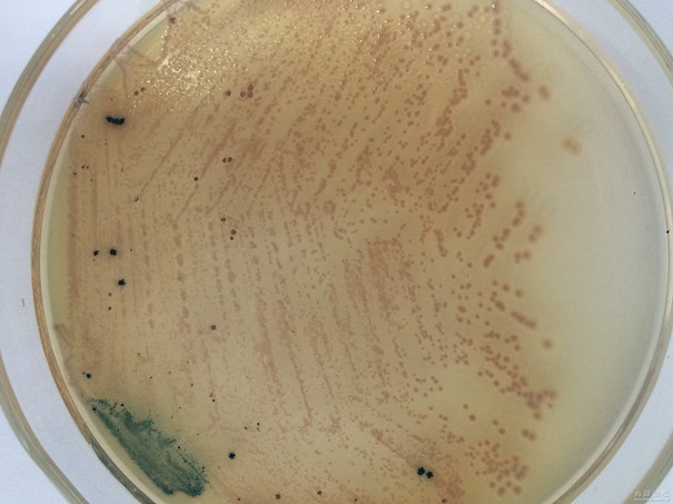 微生物培养基的灭菌方法有哪些？这些因素影响它的灭菌效果！