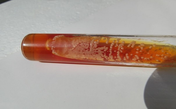 标准菌株有哪些种类？它的复壮步骤是这样的！